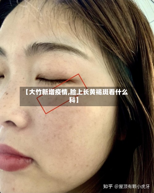 【大竹新增疫情,脸上长黄褐斑看什么科】